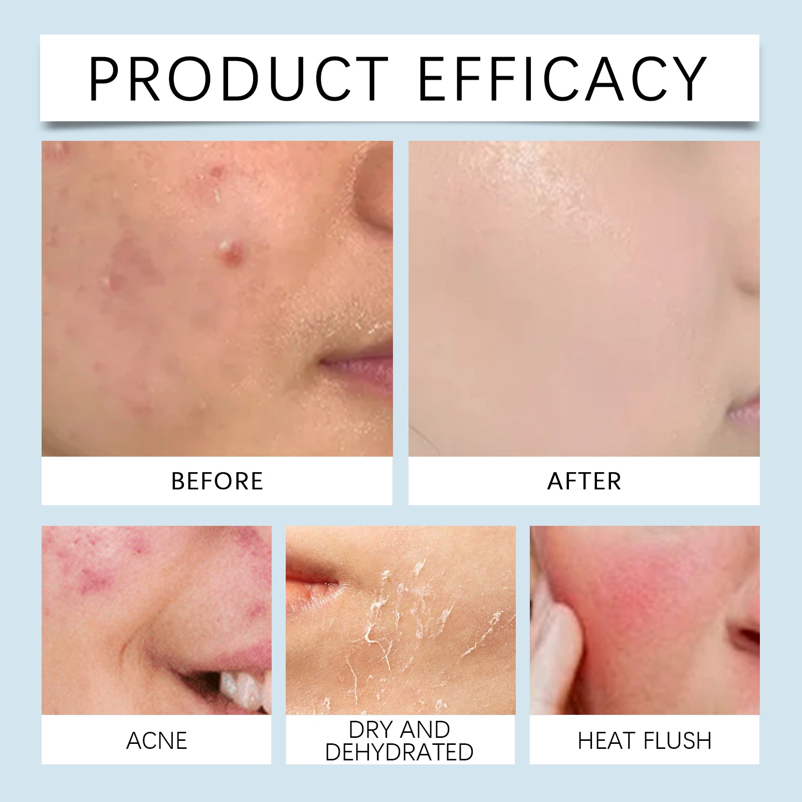 Hyaluronic Acid Face Serum Hydrating Pore Care